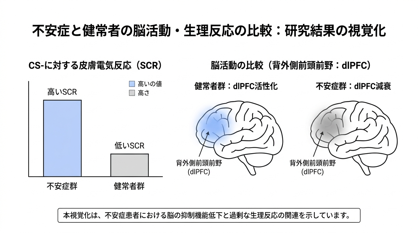 A minimalist data visualization comparing anxiety disorder patients vs healthy controls. Left section: two simple bar charts side by side showing "SCR to CS-" — anxiety group bar is taller (highlighted in soft blue), control group bar is shorter (gray). Right section: a simplified brain outline from the side view, with the left dorsolateral prefrontal cortex area highlighted — shown as active (soft blue glow) for controls and dimmed (gray) for anxiety patients. White background, monochrome with soft blue accent, clean modern editorial style, labeled with minimal text, no photorealism.