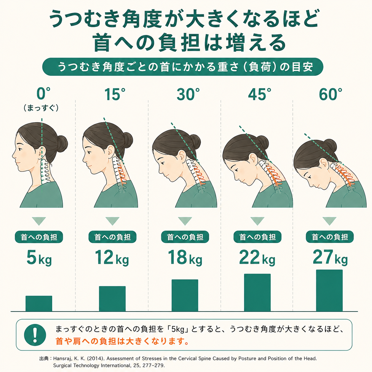 Data visualization: a side profile of a head/neck at increasing forward angles (0,15,30,45,60 degrees) with load labels 5kg,12kg,18kg,22kg,27kg. Clean medical-friendly flat style, teal #2E7D6B accent, cream background, clear numeric callouts, minimal. 1:1.